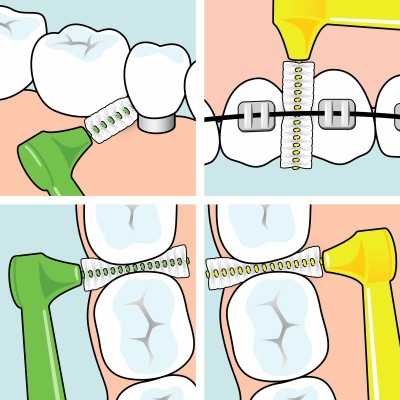Tepe Angle Scov VERDE 0,8 mm 6 pz | Farma di Fiducia