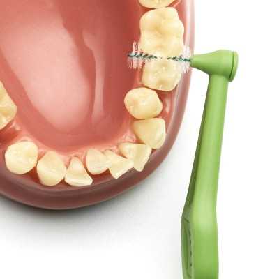 Tepe Angle Scov VERDE 0,8 mm 6 pz | Farma di Fiducia
