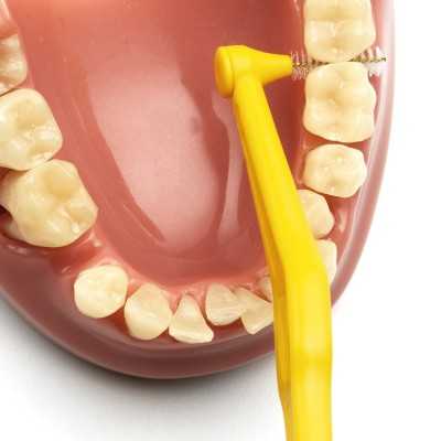 TePe Angle™ Giallo (ISO 4 - 0,7) 6Pz | Risparmia in Farmacia